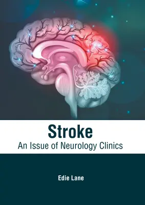 Ictus: Un numero delle Cliniche di Neurologia - Stroke: An Issue of Neurology Clinics