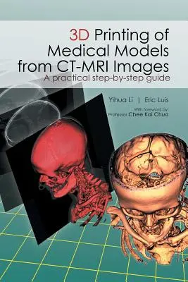 Stampa 3D di modelli medici da immagini di risonanza magnetica: Una guida pratica passo-passo - 3D Printing of Medical Models from CT-MRI Images: A Practical step-by-step guide