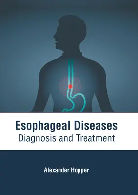 Malattie dell'esofago: Diagnosi e trattamento - Esophageal Diseases: Diagnosis and Treatment
