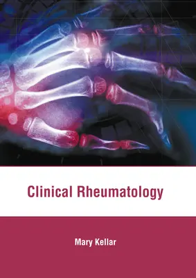 Reumatologia clinica - Clinical Rheumatology