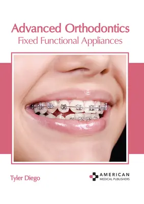 Ortodonzia avanzata: Apparecchi funzionali fissi - Advanced Orthodontics: Fixed Functional Appliances