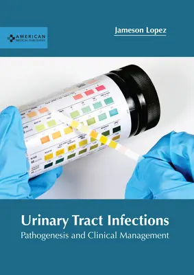 Infezioni delle vie urinarie: Patogenesi e gestione clinica - Urinary Tract Infections: Pathogenesis and Clinical Management