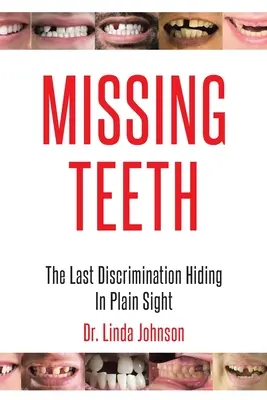 Denti mancanti: L'ultima discriminazione che si nasconde in bella vista - Missing Teeth: The Last Discrimination Hiding in Plain Sight