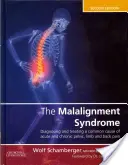 La sindrome da disallineamento: Diagnosi e trattamento dei comuni dolori pelvici e dorsali - The Malalignment Syndrome: Diagnosis and Treatment of Common Pelvic and Back Pain