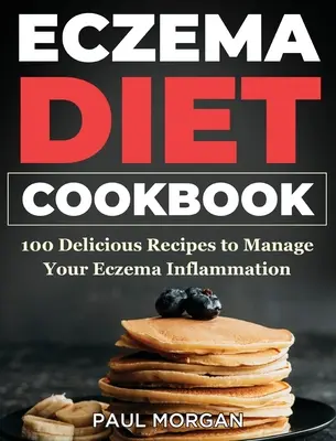Ricettario per la dieta dell'eczema: 100 deliziose ricette per gestire l'infiammazione da eczema - Eczema DIet Cookbook: 100 Delicious Recipes to Manage your Eczema Inflammation
