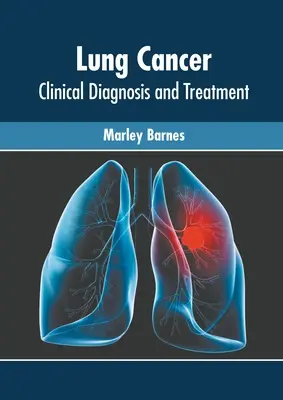 Cancro del polmone: Diagnosi clinica e trattamento - Lung Cancer: Clinical Diagnosis and Treatment