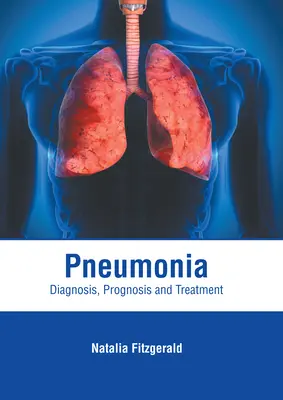 Polmonite: Diagnosi, prognosi e trattamento - Pneumonia: Diagnosis, Prognosis and Treatment