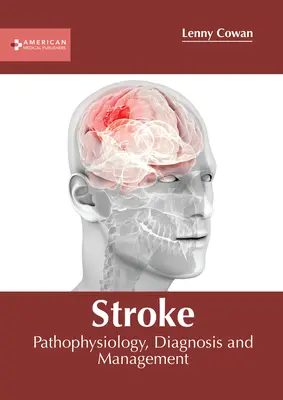 Ictus: Fisiopatologia, Diagnosi e Gestione - Stroke: Pathophysiology, Diagnosis and Management