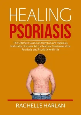 Guarire la psoriasi: La guida definitiva su come curare la psoriasi in modo naturale, scoprire tutti i trattamenti naturali per la psoriasi e la malattia psoriasica. - Healing Psoriasis: The Ultimate Guide on How to Cure Psoriasis Naturally, Discover All the Natural Treatments For Psoriasis and Psoriatic