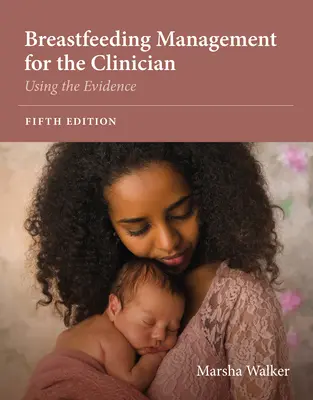 Gestione dell'allattamento al seno per il medico: Usare l'evidenza - Breastfeeding Management for the Clinician: Using the Evidence