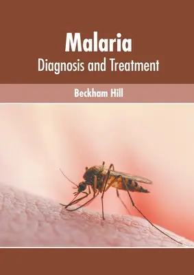Malaria: diagnosi e trattamento - Malaria: Diagnosis and Treatment