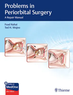 Problemi di chirurgia periorbitale: Manuale di riparazione - Problems in Periorbital Surgery: A Repair Manual