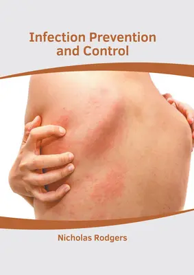 Prevenzione e controllo delle infezioni - Infection Prevention and Control