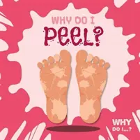 Perché mi sbuccio? - Why Do I Peel?