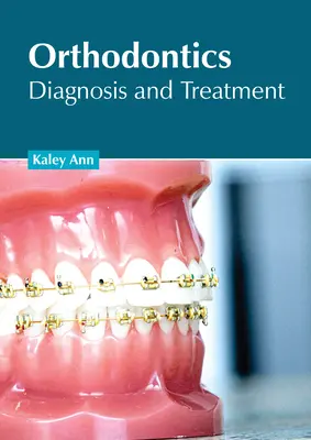 Ortodonzia: Diagnosi e trattamento - Orthodontics: Diagnosis and Treatment