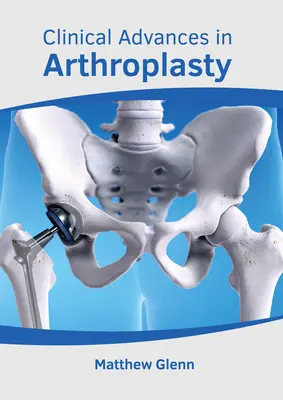 Progressi clinici nell'artroplastica - Clinical Advances in Arthroplasty