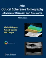 Atlante di tomografia a coerenza ottica delle malattie maculari e del glaucoma - Atlas Optical Coherence Tomography of Macular Diseases and Glaucoma