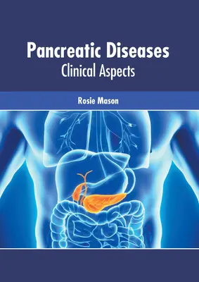 Malattie del pancreas: Aspetti clinici - Pancreatic Diseases: Clinical Aspects