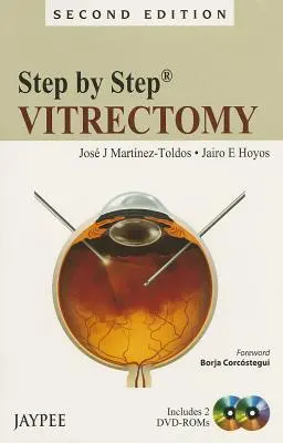 Passo dopo passo: Vitrectomia [Con 2 dvd] - Step by Step: Vitrectomy [With 2 Dvdroms]