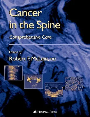 Cancro alla colonna vertebrale: Cura completa - Cancer in the Spine: Comprehensive Care