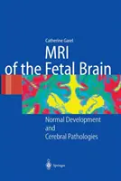 Risonanza magnetica del cervello fetale: Sviluppo normale e patologie cerebrali - MRI of the Fetal Brain: Normal Development and Cerebral Pathologies