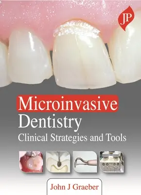 Odontoiatria microinvasiva - Strategie cliniche e strumenti - Microinvasive Dentistry - Clinical Strategies and Tools