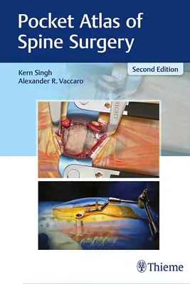Atlante tascabile di chirurgia vertebrale - Pocket Atlas of Spine Surgery