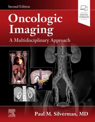 Imaging oncologico: Un approccio multidisciplinare - Oncologic Imaging: A Multidisciplinary Approach