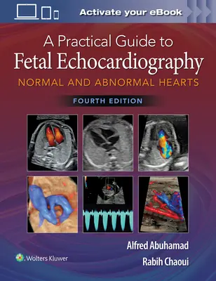 Guida pratica all'ecocardiografia fetale: Cuori normali e anormali - A Practical Guide to Fetal Echocardiography: Normal and Abnormal Hearts
