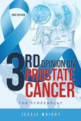 Il terzo parere sul cancro alla prostata: La sceneggiatura - 3rd Opinion on Prostate Cancer: The Screenplay