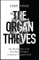 Ladri di organi: la storia scioccante del primo trapianto di cuore nel Sud segregato dell'America - Organ Thieves - The Shocking Story of the First Heart Transplant in America's Segregated South