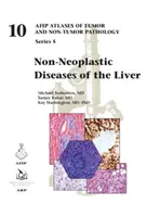 Malattie non neoplastiche del fegato - Non-Neoplastic Diseases of the Liver