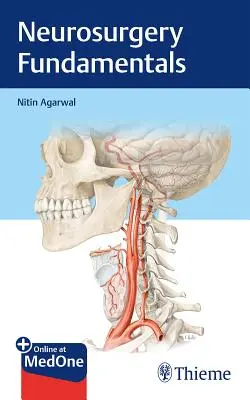 Fondamenti di neurochirurgia - Neurosurgery Fundamentals