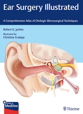 Chirurgia dell'orecchio illustrata: Un atlante completo delle tecniche microchirurgiche otologiche - Ear Surgery Illustrated: A Comprehensive Atlas of Otologic Microsurgical Techniques