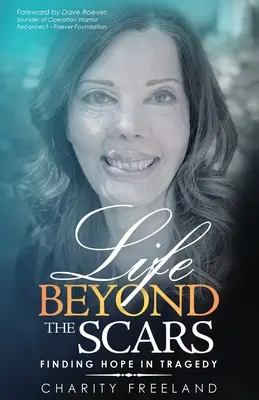 La vita oltre le cicatrici: Trovare la speranza nella tragedia - Life Beyond the Scars: Finding Hope in Tragedy