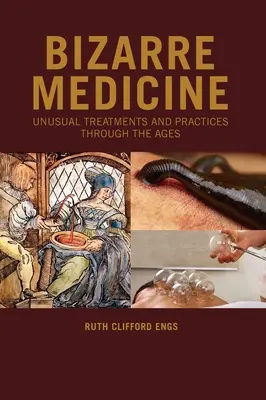Medicina bizzarra: Trattamenti e pratiche insolite attraverso i secoli - Bizarre Medicine: Unusual Treatments and Practices through the Ages