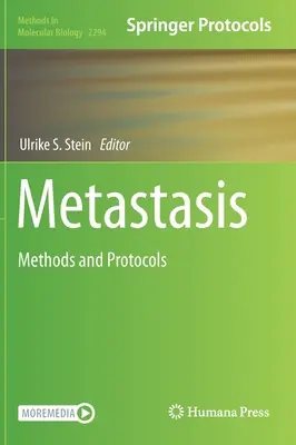 Metastasi: Metodi e protocolli - Metastasis: Methods and Protocols