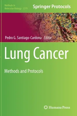 Cancro del polmone: Metodi e protocolli - Lung Cancer: Methods and Protocols
