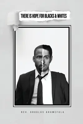 C'è speranza per i neri e i bianchi - There Is Hope for Blacks & Whites