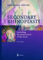 Rinoplastica secondaria: Compresa la ricostruzione del naso - Secondary Rhinoplasty: Including Reconstruction of the Nose