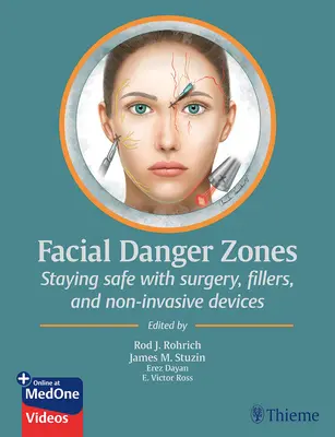 Zone di pericolo del viso: Sicurezza con la chirurgia, i filler e i dispositivi non invasivi - Facial Danger Zones: Staying Safe with Surgery, Fillers, and Non-Invasive Devices