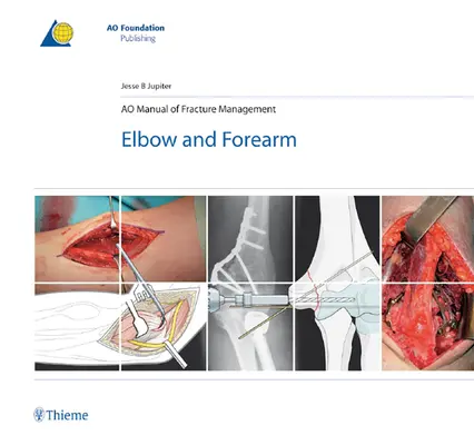Manuale Ao di gestione delle fratture - Gomito e avambraccio - Ao Manual of Fracture Management - Elbow & Forearm