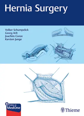Chirurgia dell'ernia - Hernia Surgery