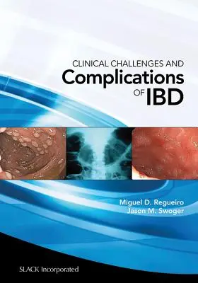 Sfide cliniche e complicanze dell'Ibd - Clinical Challenges and Complications of Ibd