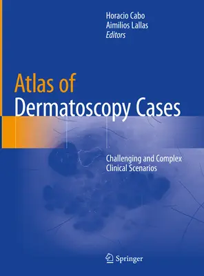 Atlante dei casi di dermatoscopia: Scenari clinici complessi e impegnativi - Atlas of Dermatoscopy Cases: Challenging and Complex Clinical Scenarios