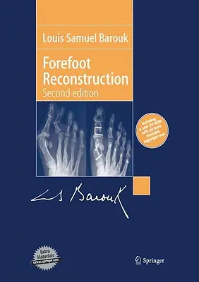 Ricostruzione dell'avampiede - Forefoot Reconstruction