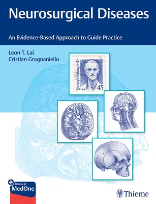Malattie neurochirurgiche: Un approccio basato sull'evidenza per guidare la pratica - Neurosurgical Diseases: An Evidence-Based Approach to Guide Practice