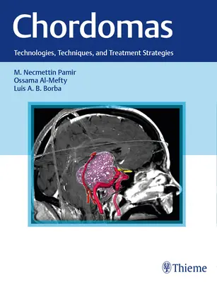 Cordomi: Tecnologie, tecniche e strategie di trattamento - Chordomas: Technologies, Techniques, and Treatment Strategies