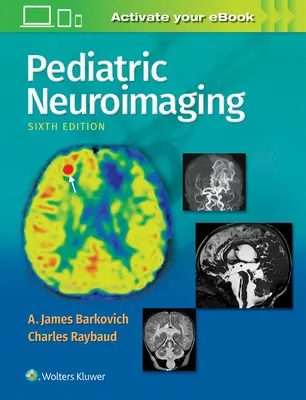 Neuroimaging pediatrico - Pediatric Neuroimaging