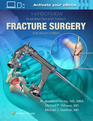 Harborview Illustrated Consigli e trucchi per la chirurgia delle fratture - Harborview Illustrated Tips and Tricks in Fracture Surgery